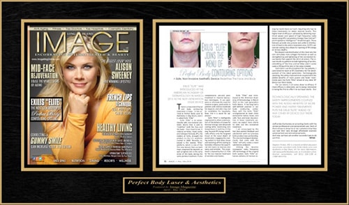 Achieving that Perfect Body: Thermage CPT, A Non-Invasive, Skin-Tightening Solution