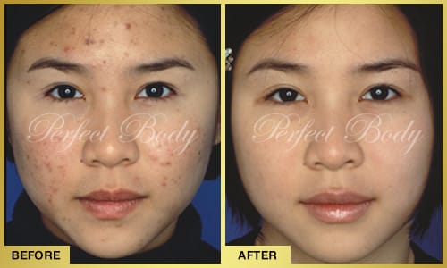 Color Correction & Skin Rejuvenation