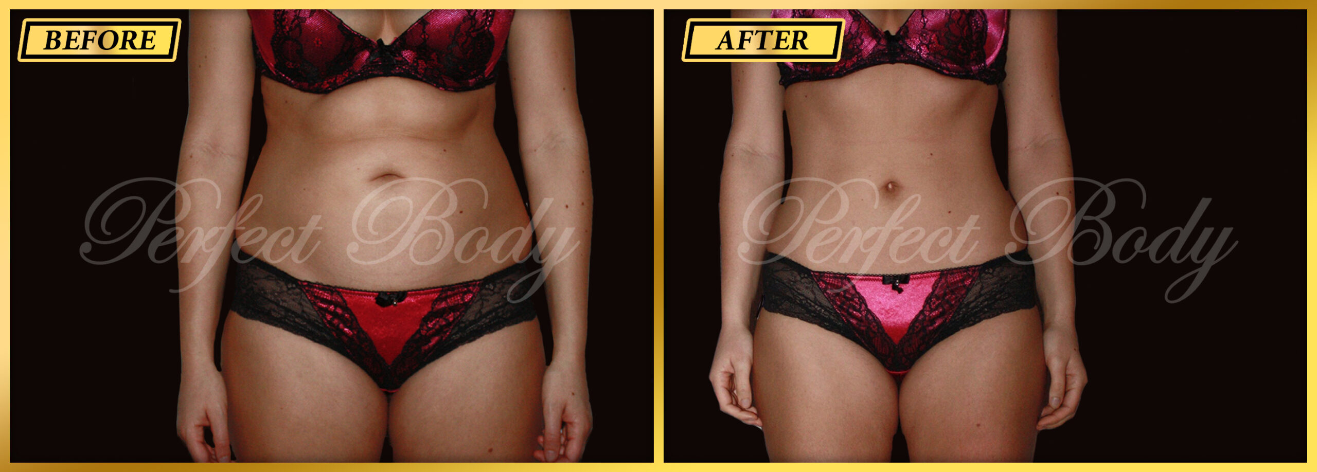 Fat Reduction Result 2